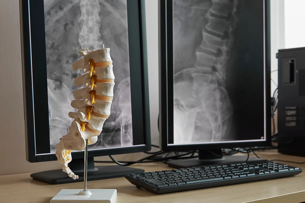 X-Rays and Fast Diagnostic in Newport Beach CA